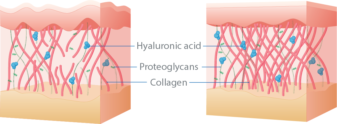 Absorbable-Collagen-Peptides